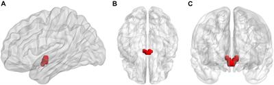 Altered Hypothalamic Functional Connectivity Following Total Sleep Deprivation in Young Adult Males